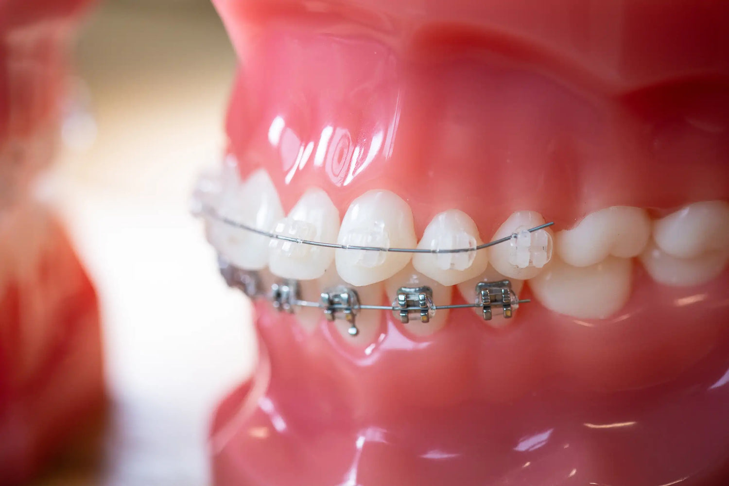 Orthodontics